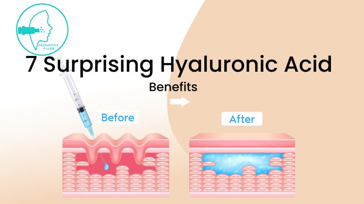 7-Surprising-Hyaluronic-Acid-Benefits-1