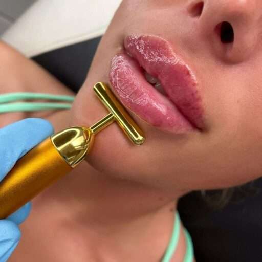 INJECTABLE DERMAL FILLERS