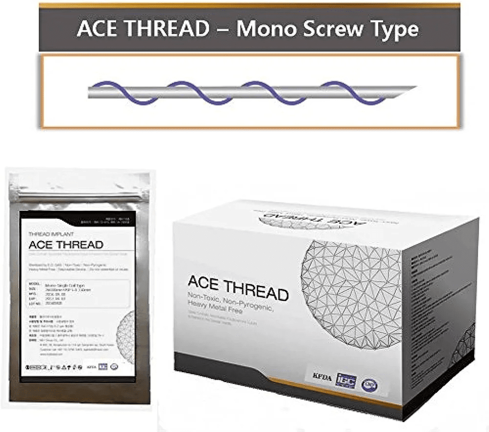 ACE PDO thread lift Mono threads